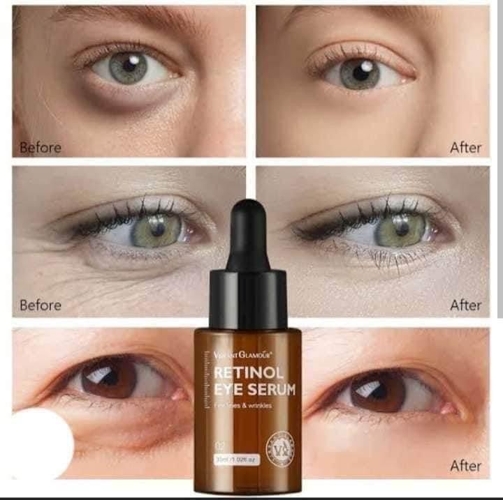 Vibrant Glamour Retinol Eye Serum - MZG Health & Beauty Imports