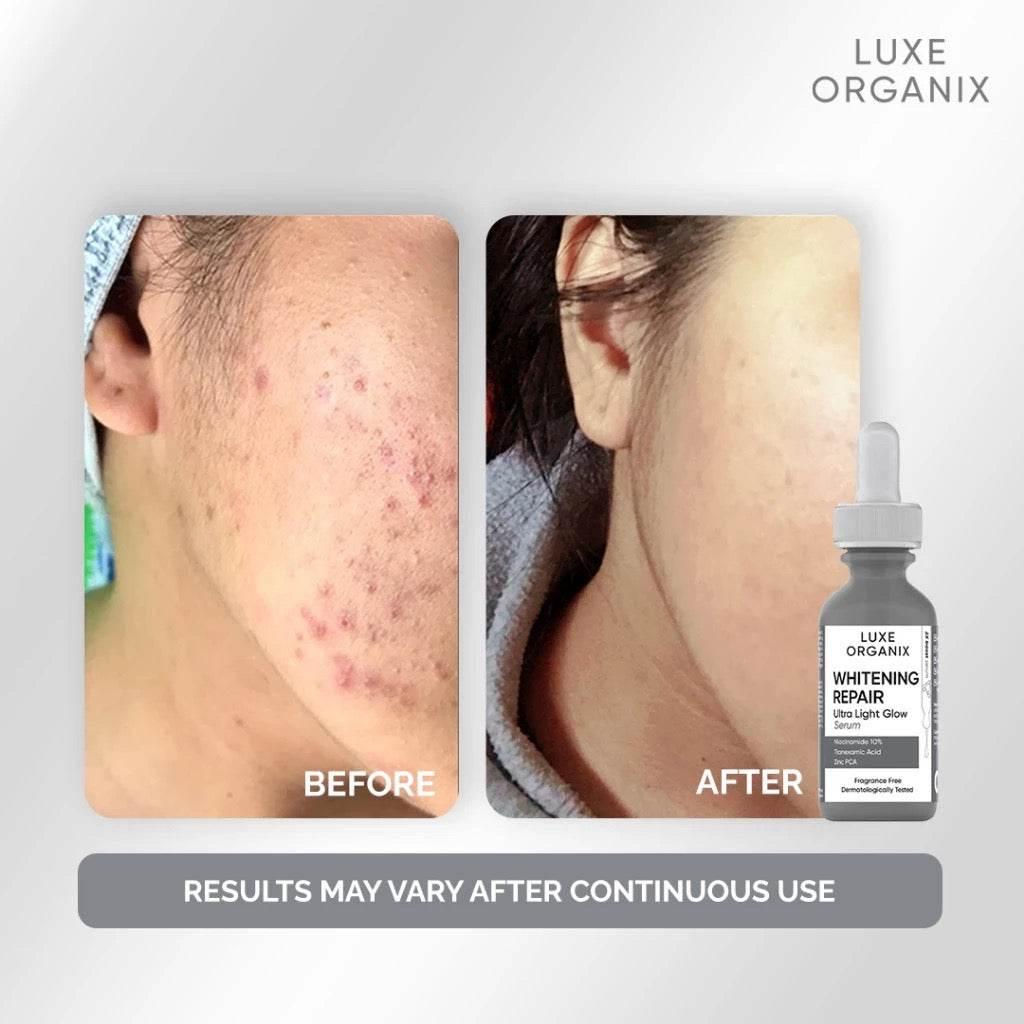 Luxe Organix Glow Serum – Whitening Repair 30ml - MZG Health & Beauty Imports