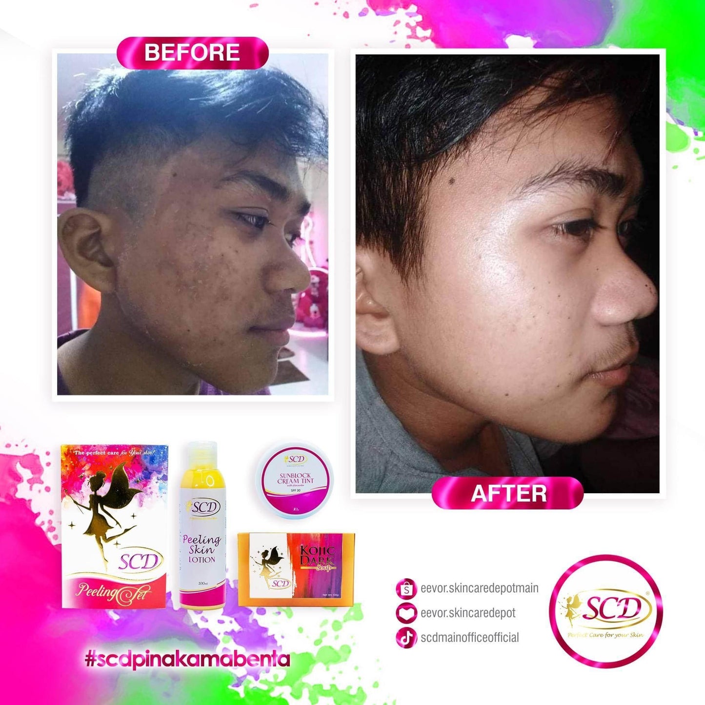 SCD Peeling Set - MZG Health & Beauty Imports