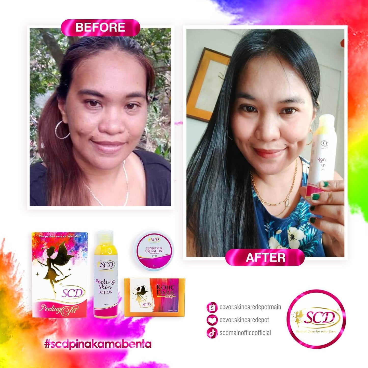 SCD Peeling Set - MZG Health & Beauty Imports