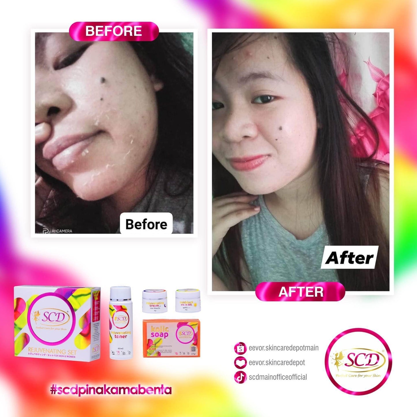 SCD Peeling Set - MZG Health & Beauty Imports