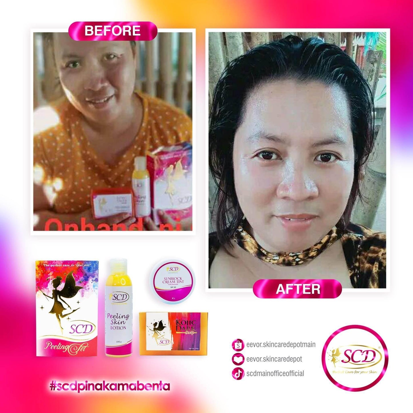 SCD Peeling Set - MZG Health & Beauty Imports