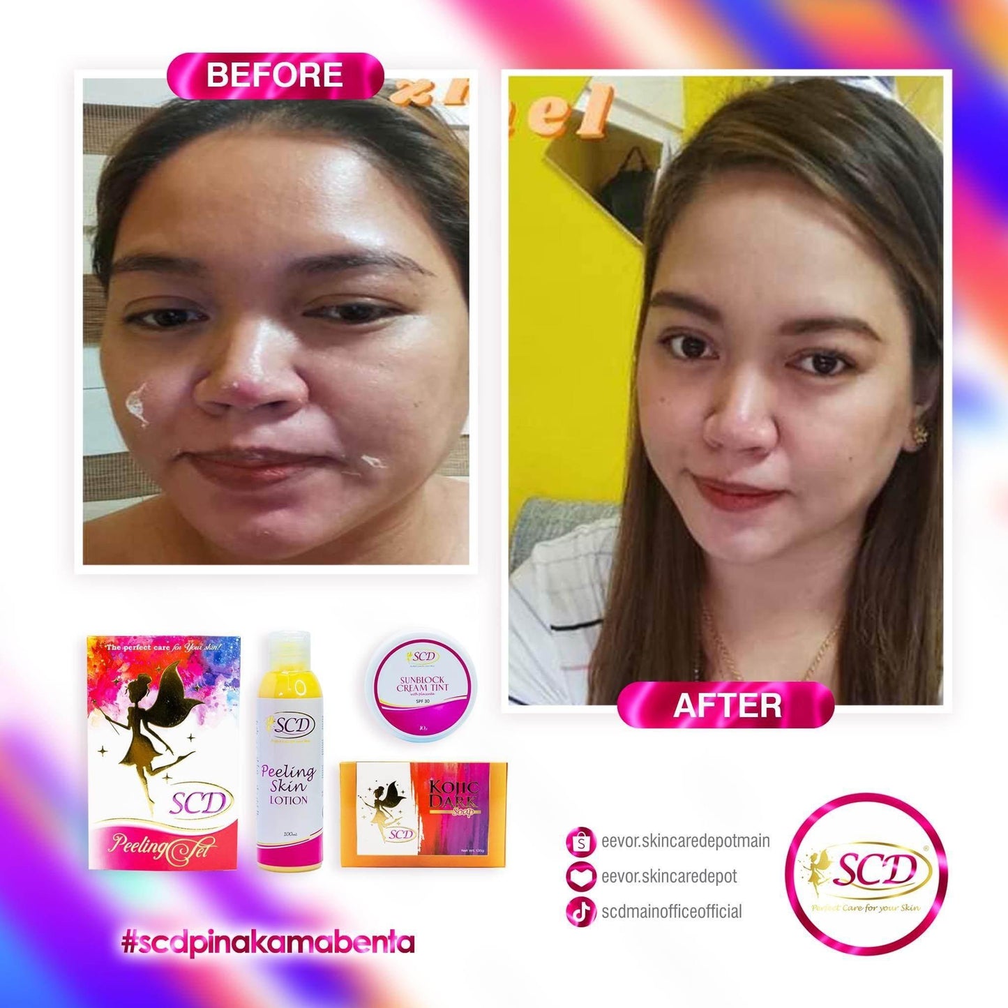 SCD Peeling Set - MZG Health & Beauty Imports