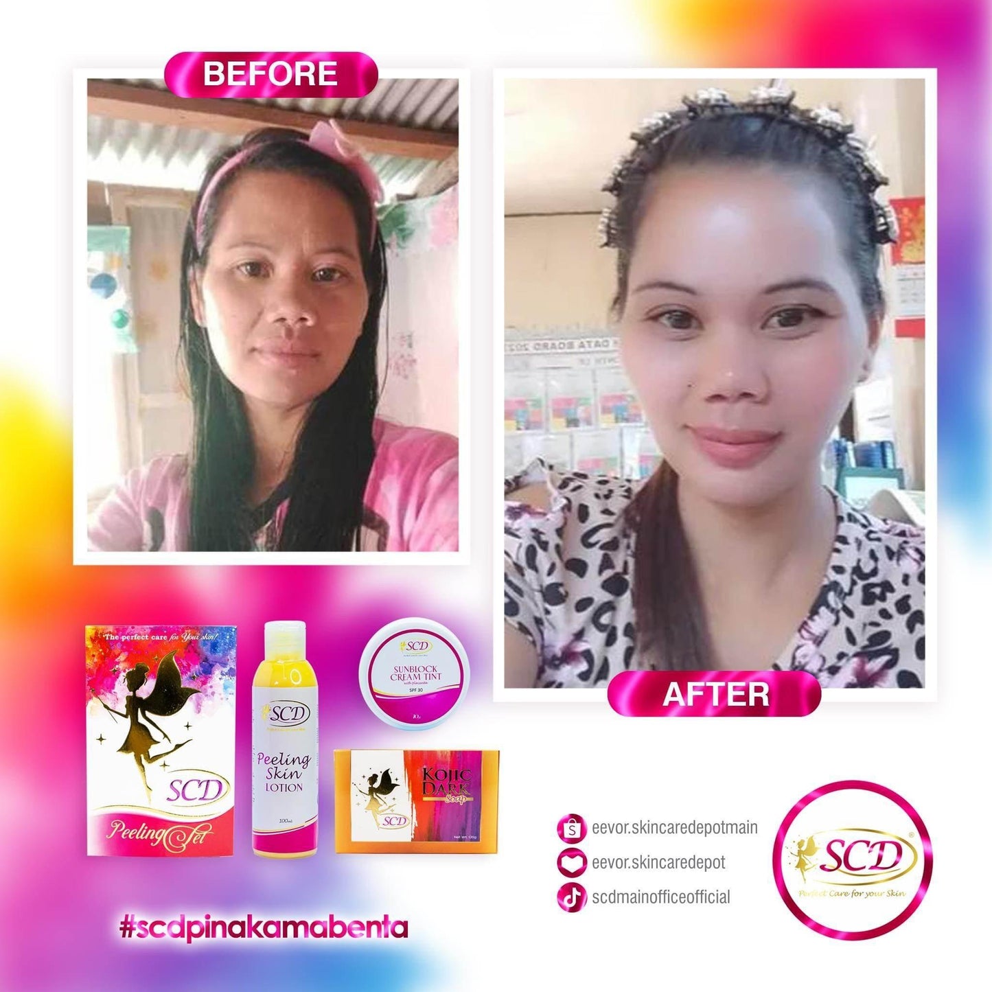 SCD Peeling Set - MZG Health & Beauty Imports