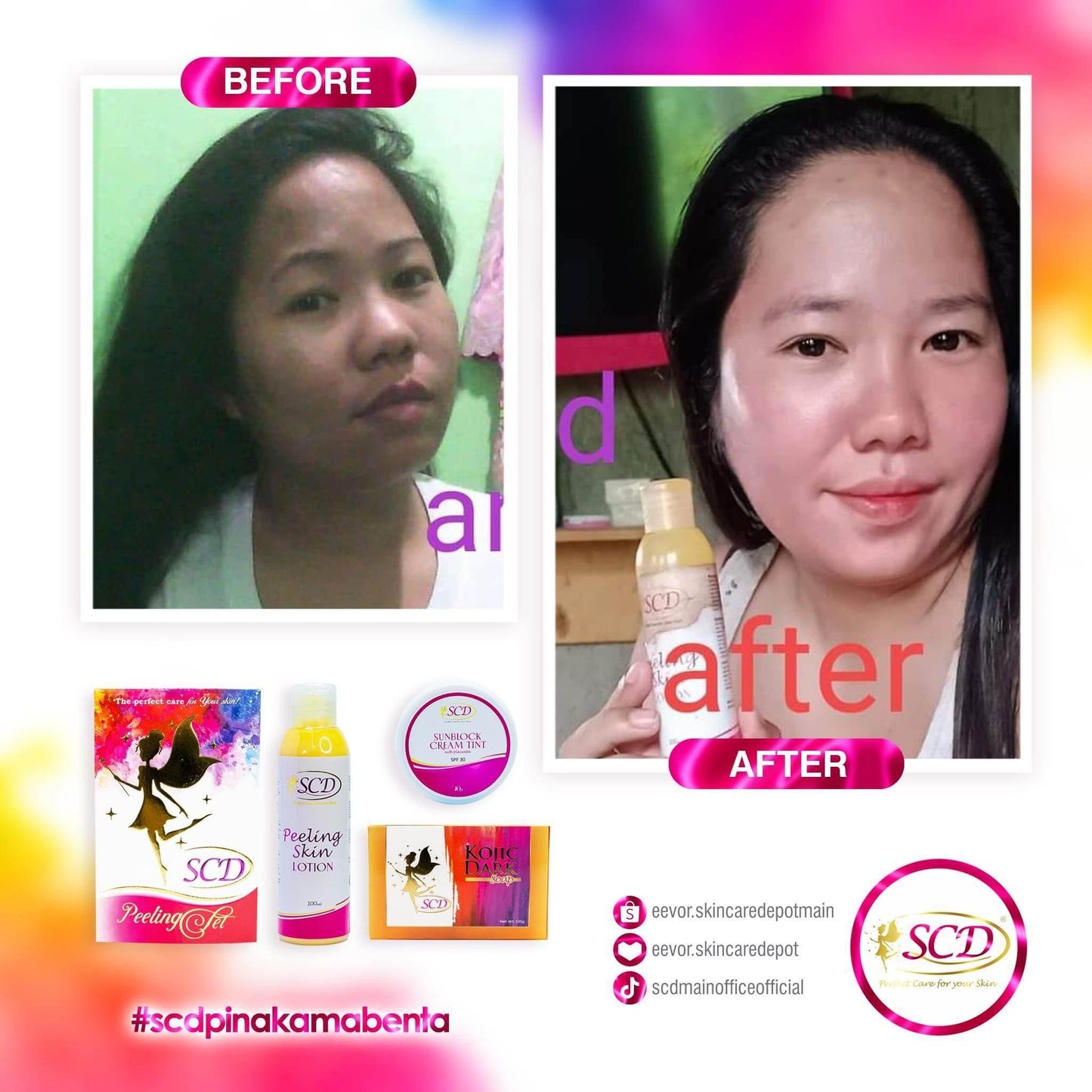 SCD Peeling Set - MZG Health & Beauty Imports