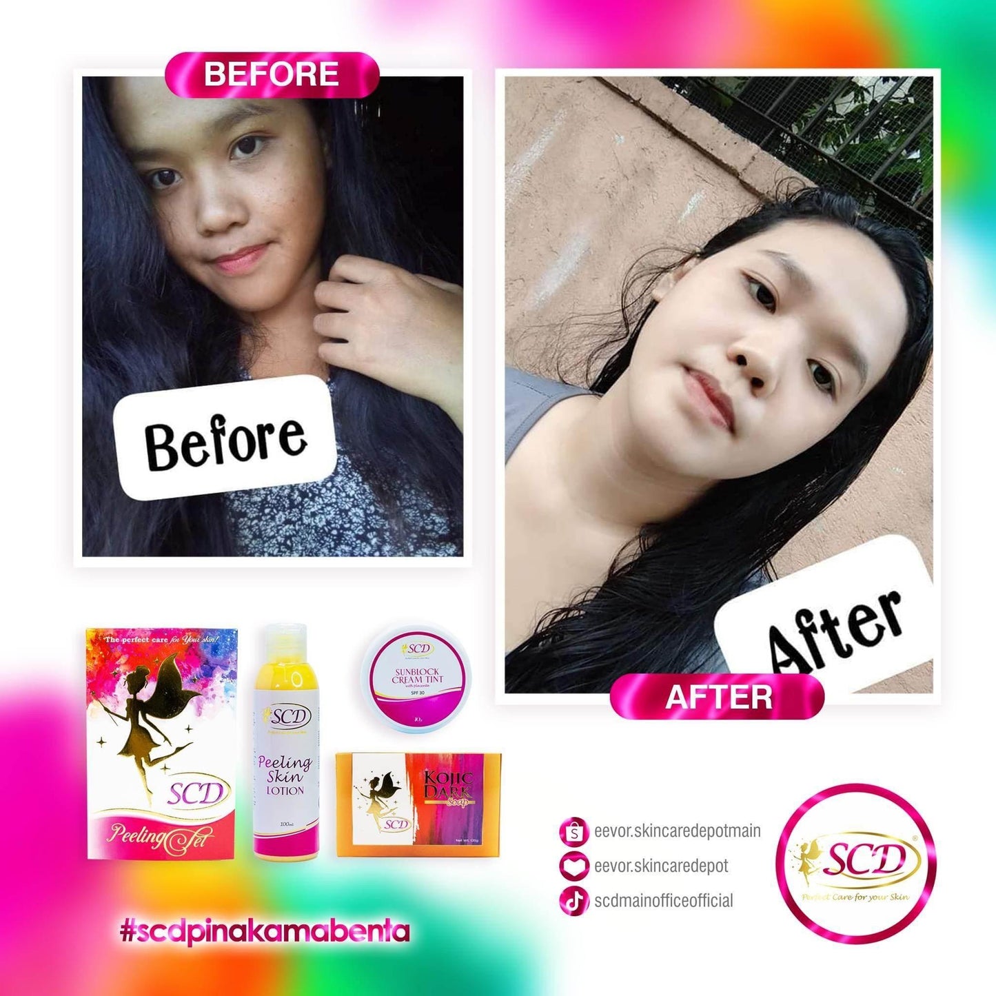 SCD Peeling Set - MZG Health & Beauty Imports