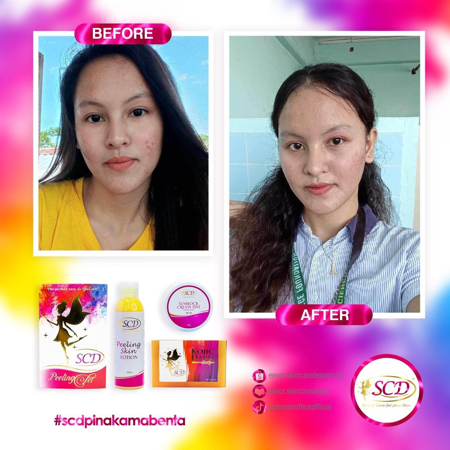 SCD Peeling Set - MZG Health & Beauty Imports
