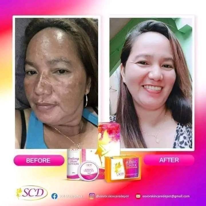 SCD Peeling Set - MZG Health & Beauty Imports