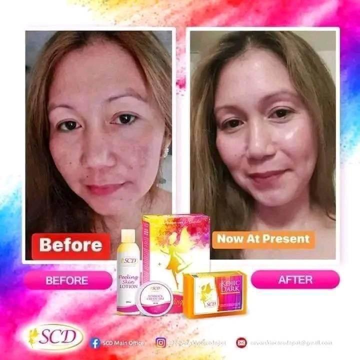 SCD Peeling Set - MZG Health & Beauty Imports