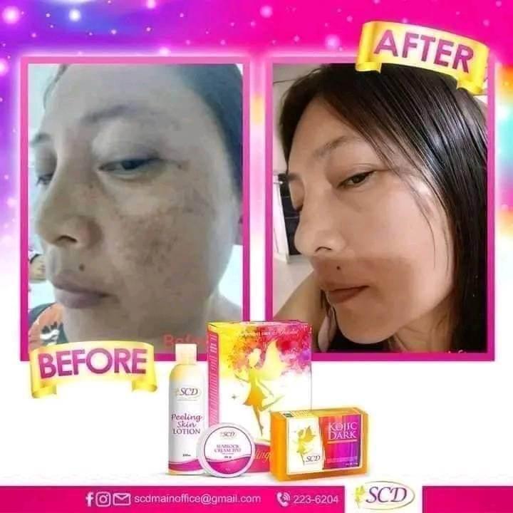 SCD Peeling Set - MZG Health & Beauty Imports