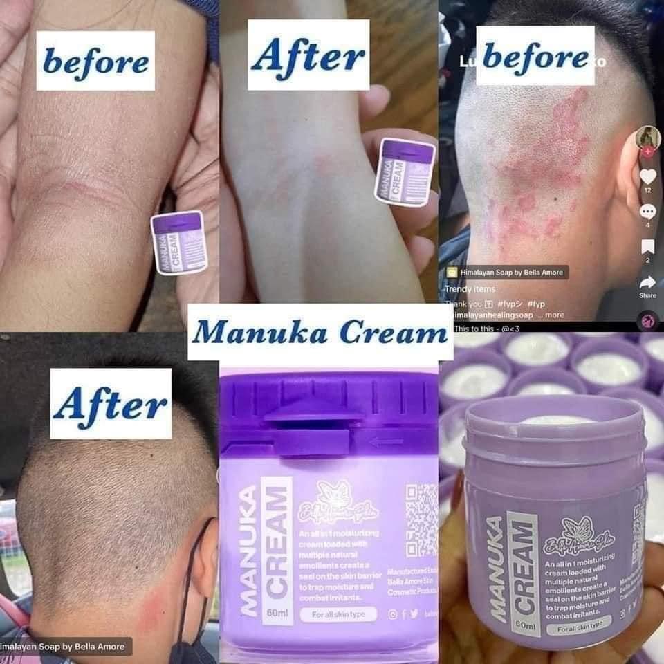 Bella Amore Skin Manuka Cream