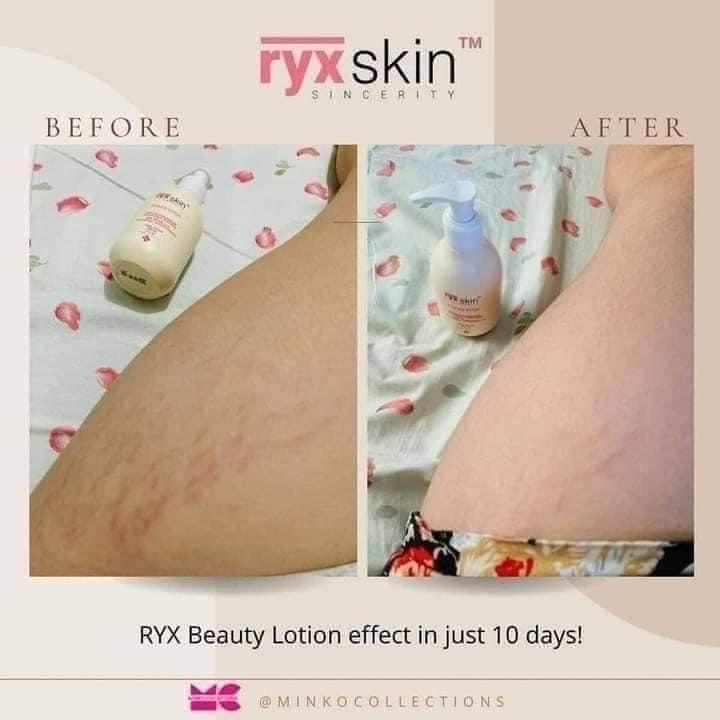 RyxSkin Beauty Lotion