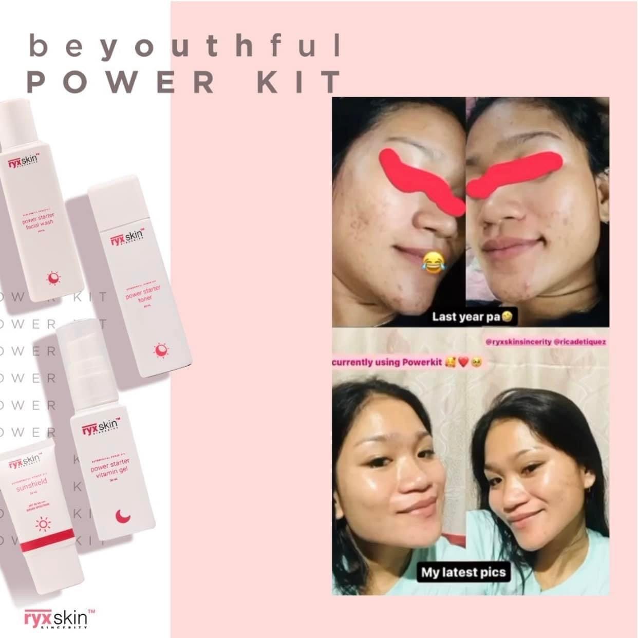 Ryxskin Beyouthiful Power Kit