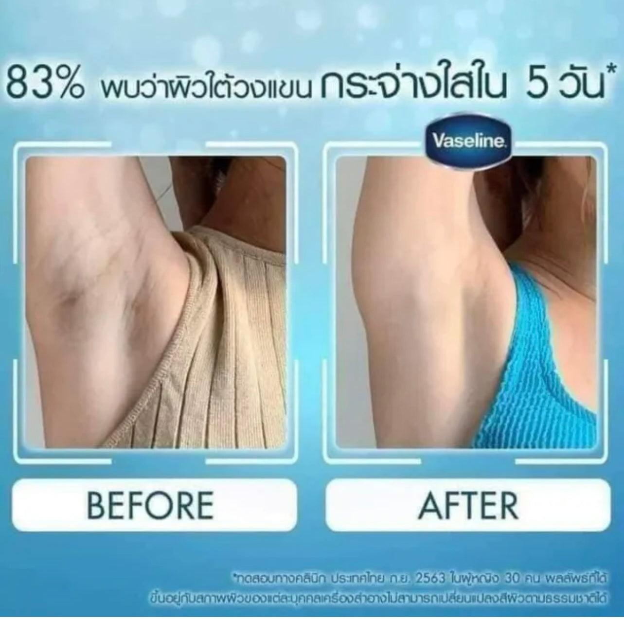 Vaseline Dry Serum Bright & Renew Underarm Whitening Cream