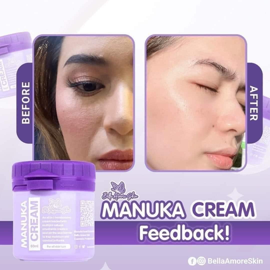 Bella Amore Skin Manuka Cream