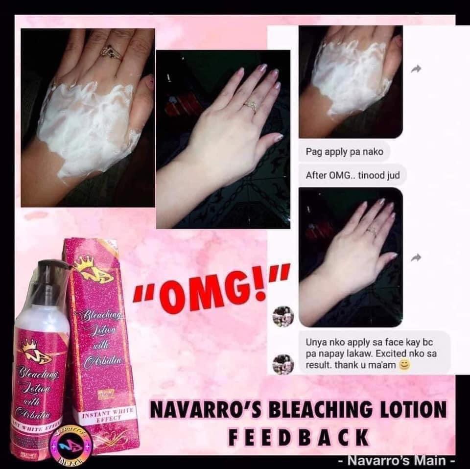 Navarro's Bleach Lotion with Arbutin