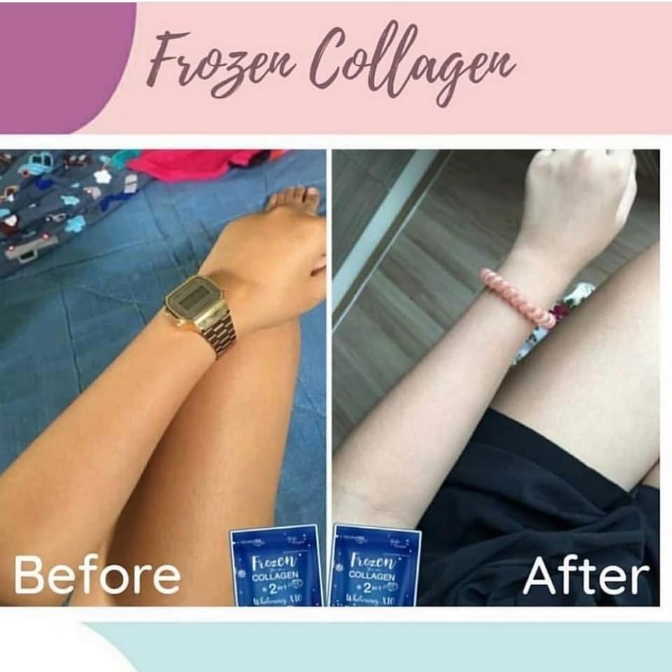 Frozen Collagen 2in1 Whitening x10 |60 Capsules